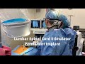 How to Perform a Lumbar Spinal Cord Stimulator Permanent Implant