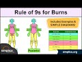 Rule of Nines for Burns MADE EASY: Adult & Baby Calculation [EMT, Nursing]