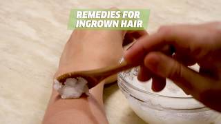 How To Get Rid Of And Remove Ingrown Hair Easy!