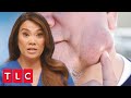 “Like a Water Balloon Filled With Oatmeal” | Dr. Pimple Popper