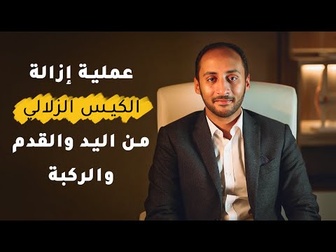 فيديو توضيحي - أ.د. عمرو ناجي