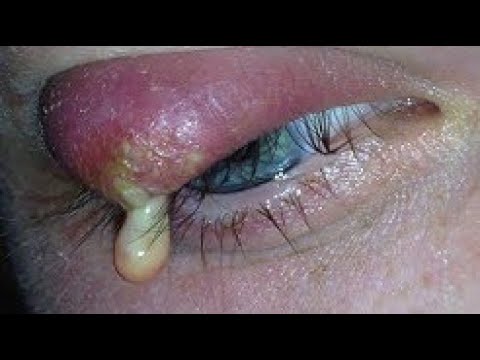 МИР БОЛЬШИХ ПРЫЩЕЙ