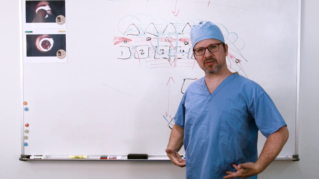 Restrictions After Surgery | Post Operation (Transforaminal Lumbar Interbody Fusion)