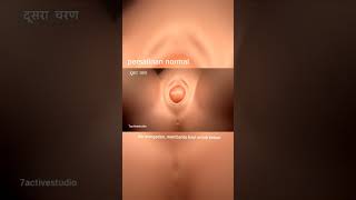 Download lagu Gambaran Proses Persalinan Normal #edukasikesehatan #kehamilan #hamil mp3 Download lagu Gambaran Proses Persalinan Normal #edukasikesehatan #kehamilan #hamil mp3