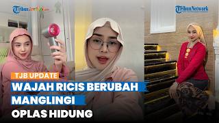 Hidung Berubah Mancung, Potret Terbaru Ria Ricis Bikin Pangling, Blak-blakan Akui Jalani Oplas
