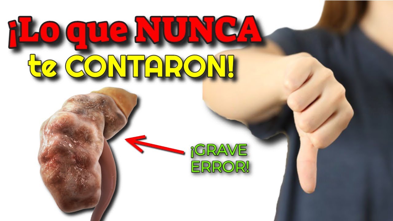 KIDNEY FAILURE! HIGH CREATININE in BLOOD SYMPTOMS | NATURAL KIDNEY CLEANSE