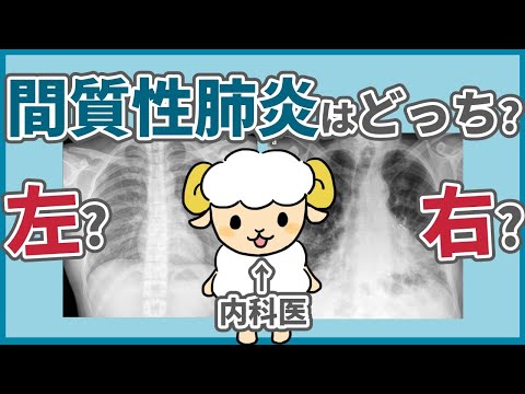 A thorough explanation of X-rays of interstitial pneumonia [You can read it in the video]
