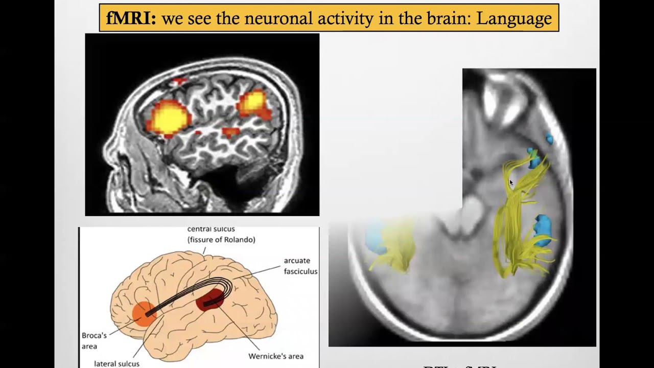 Basics of Clinical MRI in Neuropediatrics: Part 2