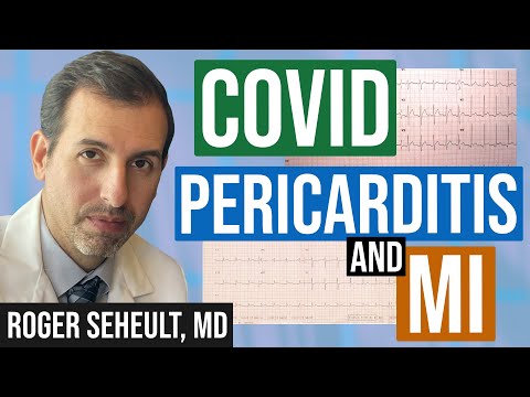 How to Distinguish Myocardial Infarction from Pericarditis on ECG