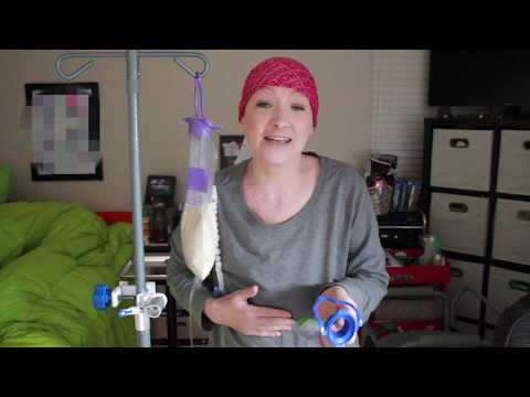 How I start my feeding using the Kangaroo Joey Pump