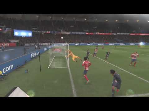 keylor navas breaks his neck