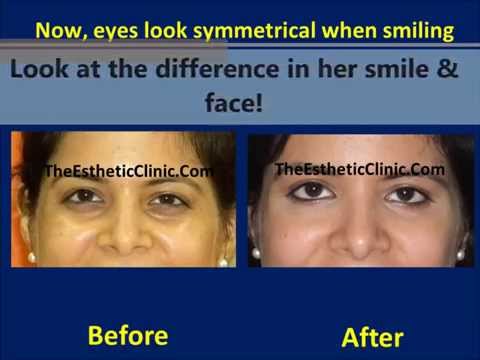 Videos from Dr. Debraj Shome