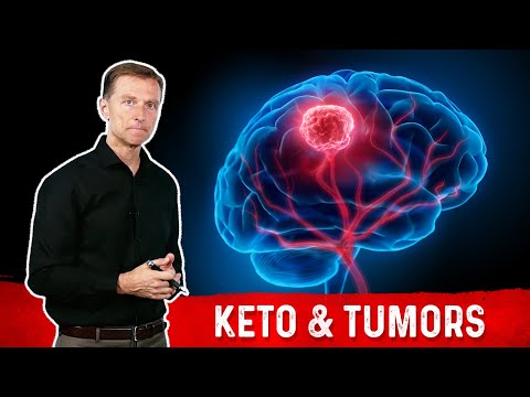 Can the Ketogenic Diet Cause Brain Tumors (Glioblastomas)?