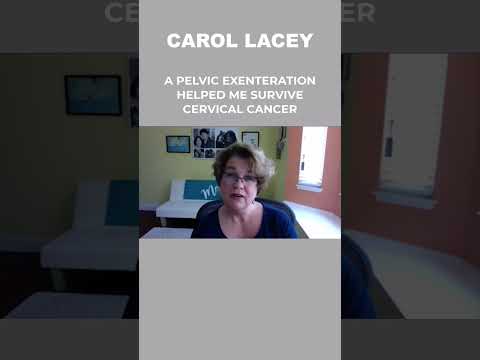 Carol Lacey survived cervical cancer, but needed a total pelvic exenteration, losing several organs.