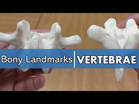 Bony Landmarks of the Vertebrae