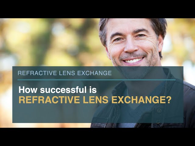 How successful is refractive lens exchange?