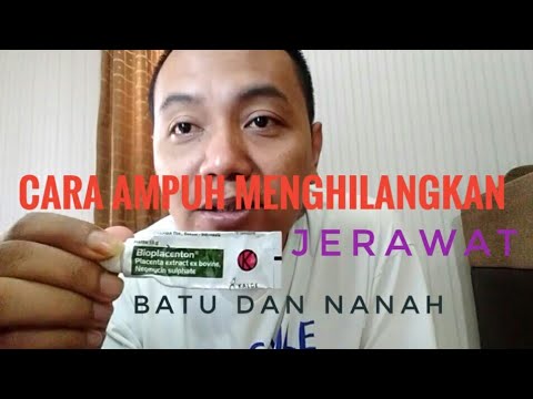 Apakah dijual di apotek patogen kuda Bagaimana untuk merangsang wanita dalam korespondensi di Internet
