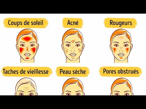 , title : '6 Masques du Visage Pour Améliorer ta Peau'