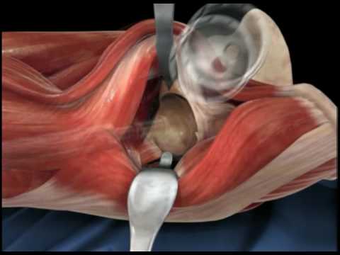 Che rendono le articolazioni fanno male le ginocchia Osteocondrosi toracica incinta