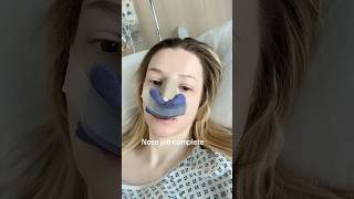 Nose job complete
