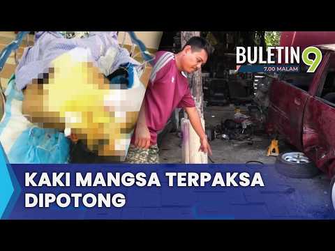Kaki Mangsa Letupan Terpaksa Dipotong Demi Elak Jangkitan Merebak (B9)