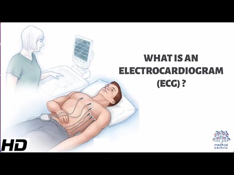 What Is An Electrocardiogram?