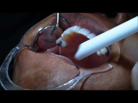 Play Video Youtube Video