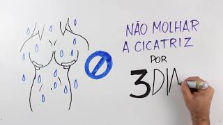 Dicas para uma boa recuperação - Prótese de Mama