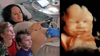 Baby Girl SMILES During 3D Ultrasound!! (AMAZING)