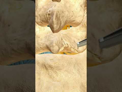 Guess The Spine Injury And Procedure Challenge