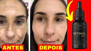 RETINOL ANTES E DEPOIS | BENEFÍCIOS DO RETINOL | COMO USAR O RETINOL NO ROSTO