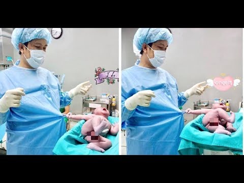 Le cas impressionnant du bébé qui s'accroche au médecin😳 quelques secondes après la naissance. Video
