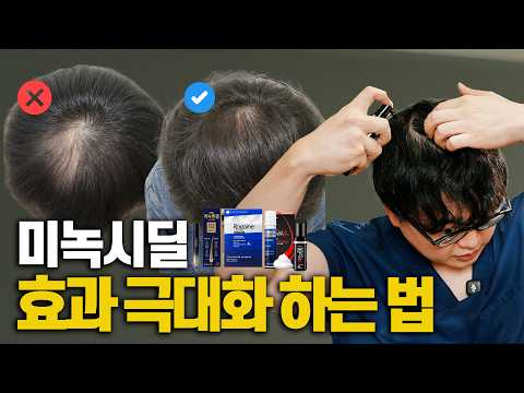 미녹시딜 이렇게 바르면 효과 꽝! 탈모에 200% 효과보는 법!