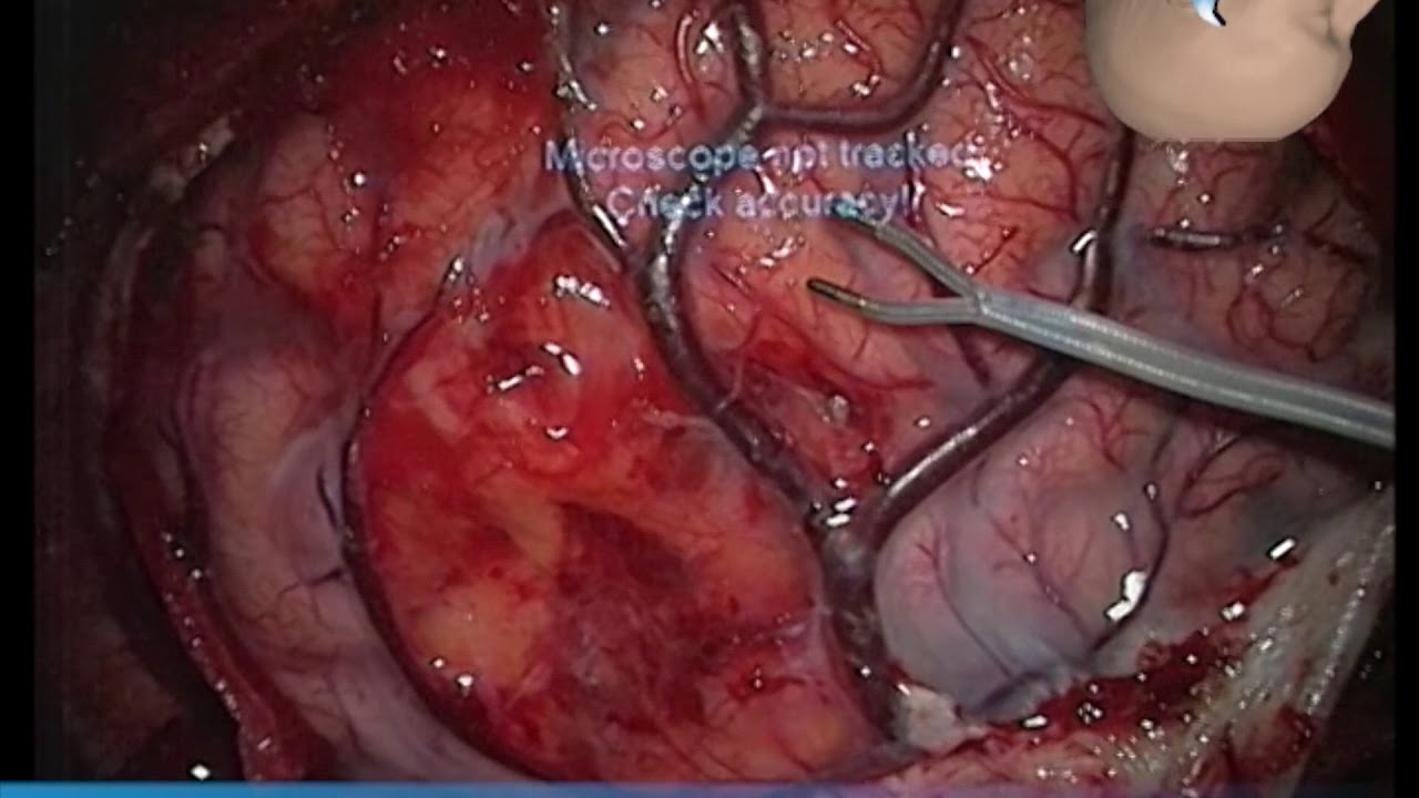 Juan Martino Gonzalez-4