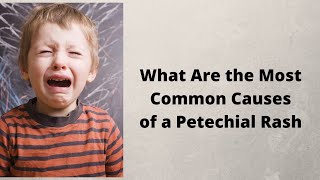 What Are the Most Common Causes of a Petechial Rash