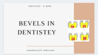 BEVELS IN DENTISTRY