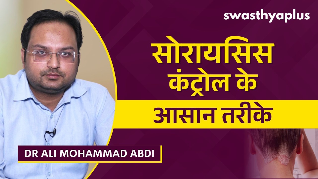सोरायसिस का इलाज क्या है? | Psoriasis: How to Treat? in Hindi | Dr Ali Mohammad Abdi
