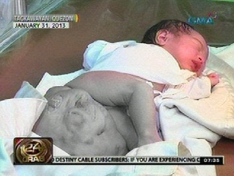 Slimming Svetlana ahtarovoy lahat ng mga larawan Kung paano mawalan ng timbang mabilis sa gym