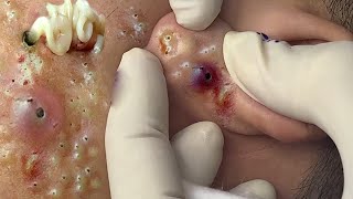 𝑅𝑒𝑐𝑙𝑎𝑖𝑚 𝑌𝑜𝑢𝑟 𝐺𝑙𝑜𝑤 𝐴𝑛𝑑 𝐶𝑎𝑙𝑚 𝑇ℎ𝑟𝑜𝑢𝑔ℎ 𝑀𝑖𝑛𝑑𝑓𝑢𝑙 𝑆𝑘𝑖𝑛𝑐𝑎𝑟𝑒 𝑀𝑜𝑚𝑒𝑛𝑡𝑠 656854