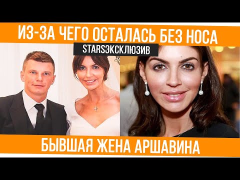 Алиса Казьмина: жена Аршавина, «Прямой эфир», осталась без носа, и на улице с детьми
