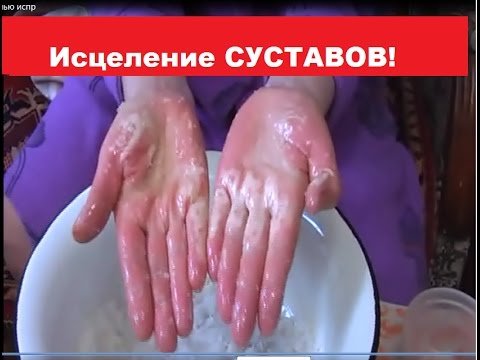 Где лечат боли в пояснице Ущемление нерва шейном отделе симптомы