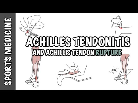 The Ankle Joint Clinical Anatomy