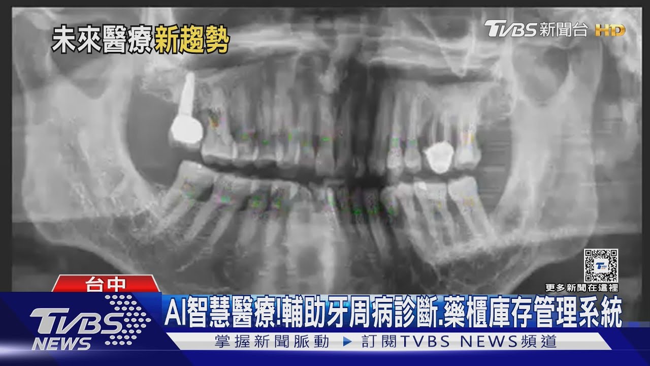 AI潮流！顯著提升「醫療服務」效率　精準判定救治「這類型」病友關鍵是它