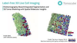 Holotomography-based integrated segmentation and 3D tumor modeling