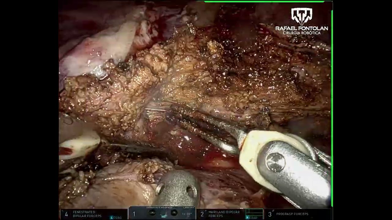 Rafael Mello Fontolan Vieira-8