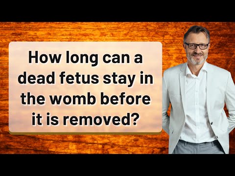How long can a dead fetus stay in the womb before it is removed?