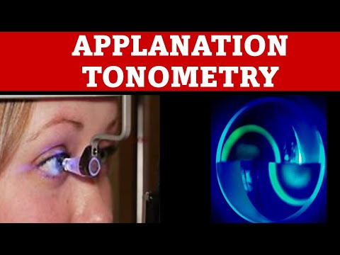 Applanation Tonometry | how to do goldmann applanation tonometry?