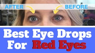 BEST EYE DROPS FOR RED EYES - HOW TO GET RID OF RED EYES IN 2 MINUTES