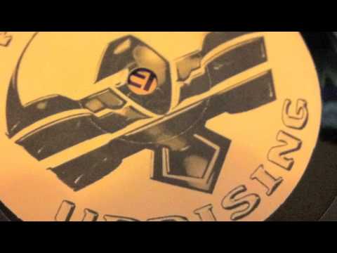 Tom Harding vs Jon the Dentist - 1988