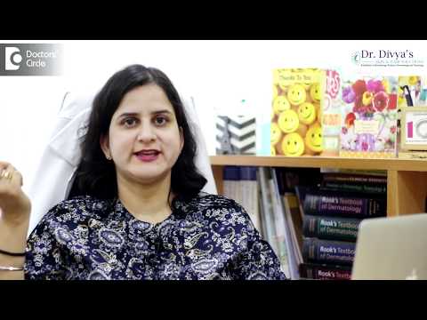 What is Alopecia Areata? | Dr. Divya Sharma